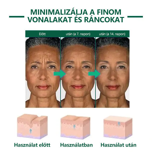 🌿Last Day Promotion SkinFirming🔥𝟕𝟎%𝐎𝐅𝐅 - 𝐅𝐮𝐛𝐬𝐭𝐚™  Szérum a Fiatalításért