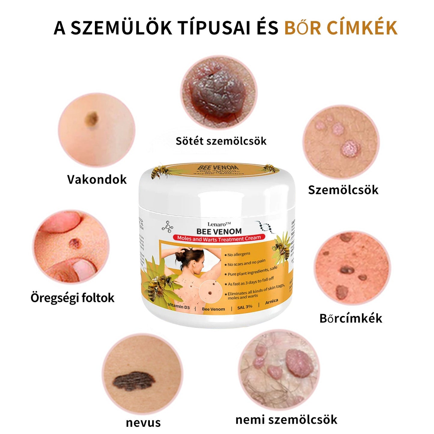 🎉🎉🎉[🍀 Hivatalos zászlóshajó üzlet 🍀] Lenaro™ Méhméreg vakond és szemölcs kezelési krém(👨‍⚕AAD AJÁNLJA)