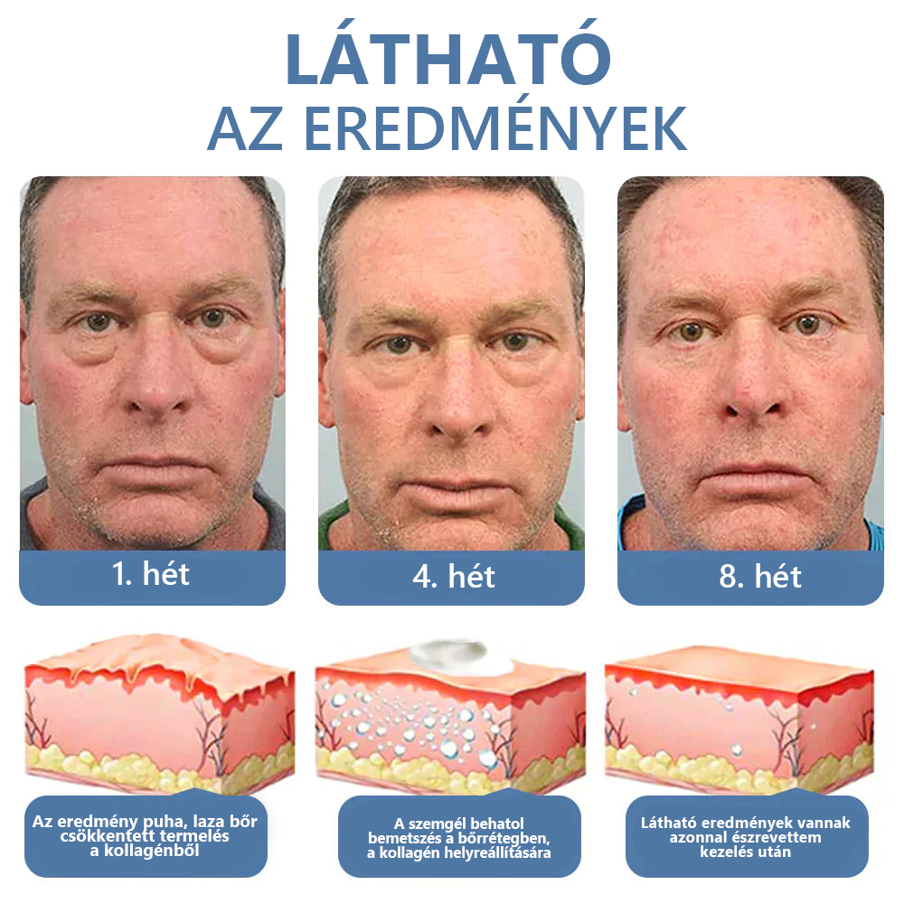 LOVILDS™ 💖 Dr. Gerald Jaar - Hungarian Eye Center Ajánlott termékek: Awaken peptid lifting szemgél x