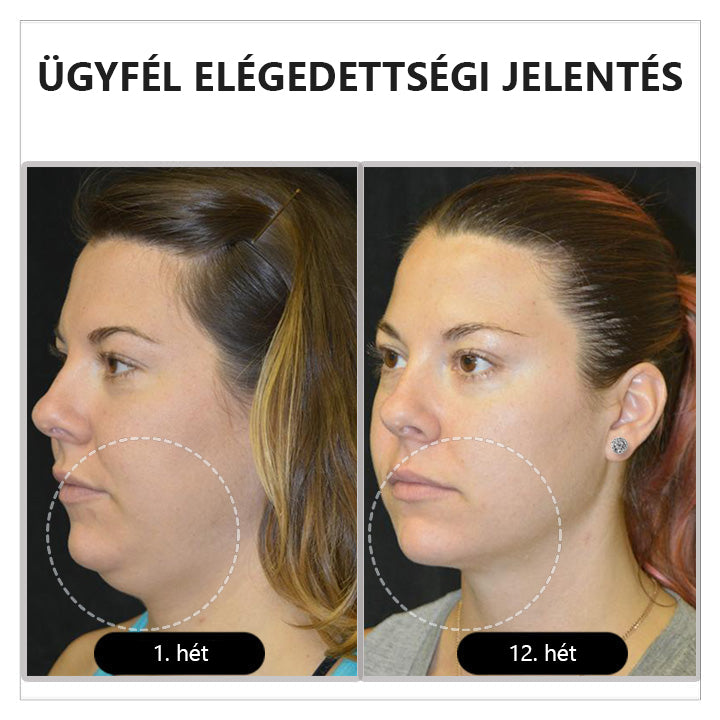 A nők potenciáljának felszabadítása 💖 CZTICLE™ Histone Magnetology Lymphvity Germanium Fülbevaló (🔥Akció utolsó napja 80% kedvezmény🔥)