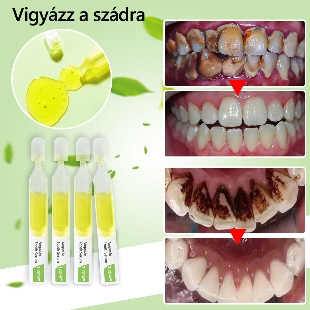 💥TLOPA™💥Ampoule fogkrém, A fogkő és a lepedékbaktériumok és különböző szájüregi problémák eltávolítása3