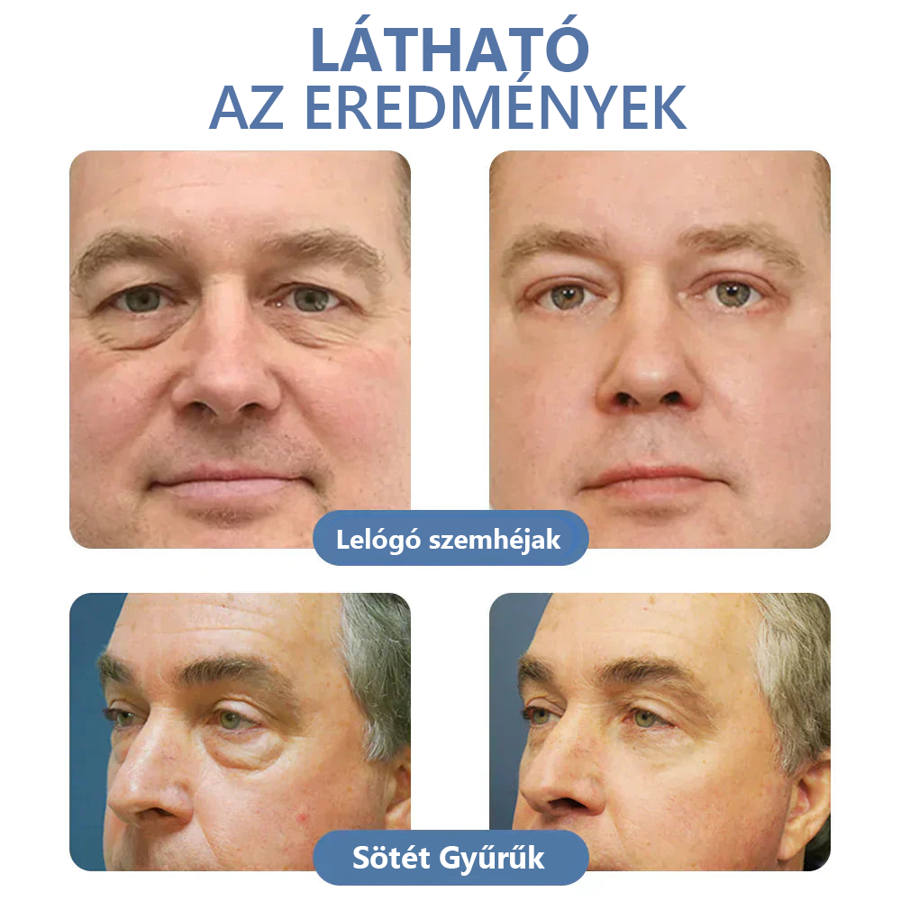 LOVILDS™ 💖 Dr. Gerald Jaar - Hungarian Eye Center Ajánlott termékek: Awaken peptid lifting szemgél x