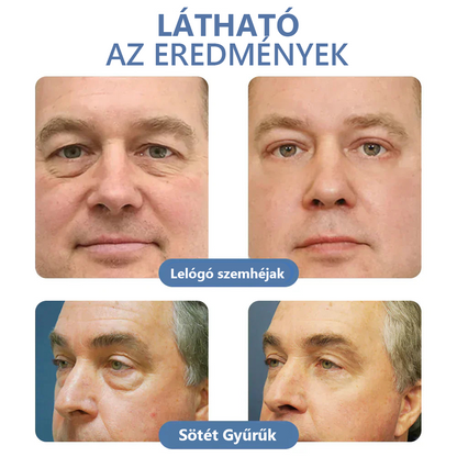 LOVILDS™ 💖 Dr. Gerald Jaar - Hungarian Eye Center Ajánlott termékek: Awaken peptid lifting szemgél x