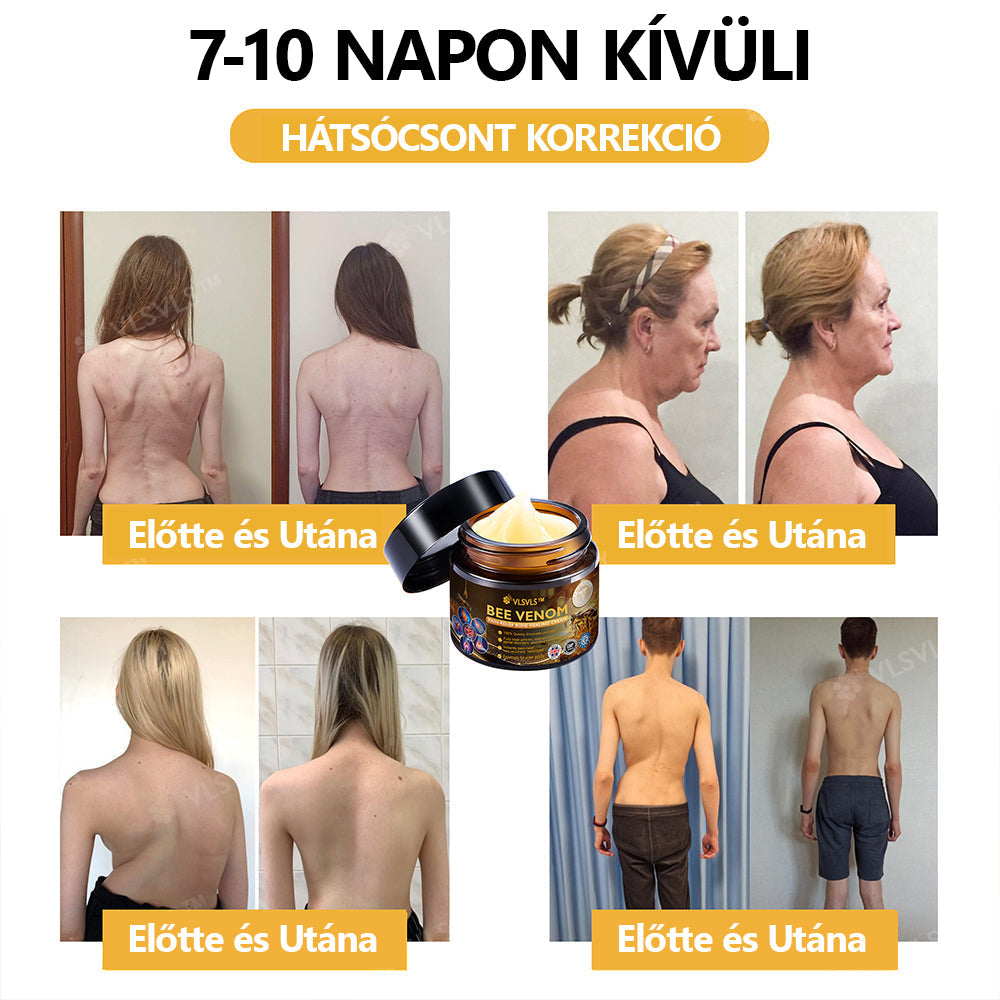 Hivatalos áruház:  🦵VLSVLS™ Méhméreg Arthritis terápiás krém(Kifejezetten az idősebb felnőttek számára & az AAOS ajánlja)🔥Utolsó nap promóció 70% le x💖💖