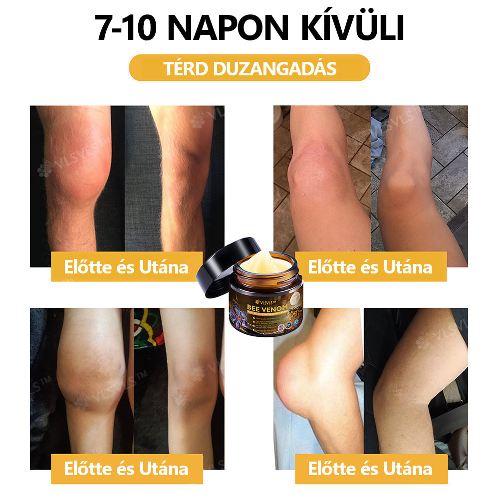 Hivatalos áruház:  🦵VLSVLS™ Méhméreg Arthritis terápiás krém(Kifejezetten az idősebb felnőttek számára & az AAOS ajánlja)🔥Utolsó nap promóció 70% le x💖💖