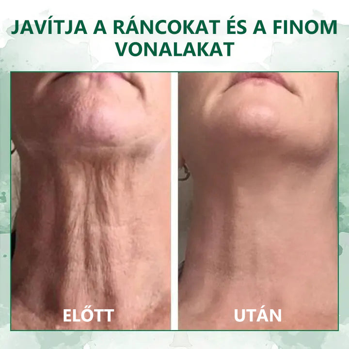 🌿Last Day Promotion SkinFirming🔥𝟕𝟎%𝐎𝐅𝐅 - 𝐅𝐮𝐛𝐬𝐭𝐚™  Szérum a Fiatalításért