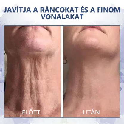 👨‍⚕️Utolsó napi kedvezmény: 80% kedvezmény👨‍⚕️Fubsta® Advanced Firming & Anti-Wrinkle Cream: helyreállítja a bőr rugalmasságát🫧