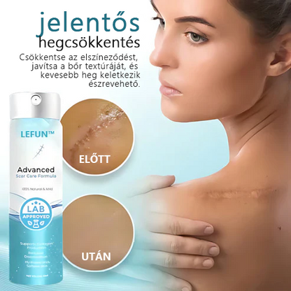 ✨✨Advanced 💧LEFUN™ Scar spray Minden típusú hegre - például aknés hegek, műtéti hegek és striák ellen.