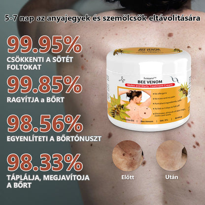 🎉🎉🎉[🍀 Hivatalos zászlóshajó üzlet 🍀] Lenaro™ Méhméreg vakond és szemölcs kezelési krém(👨‍⚕AAD AJÁNLJA)