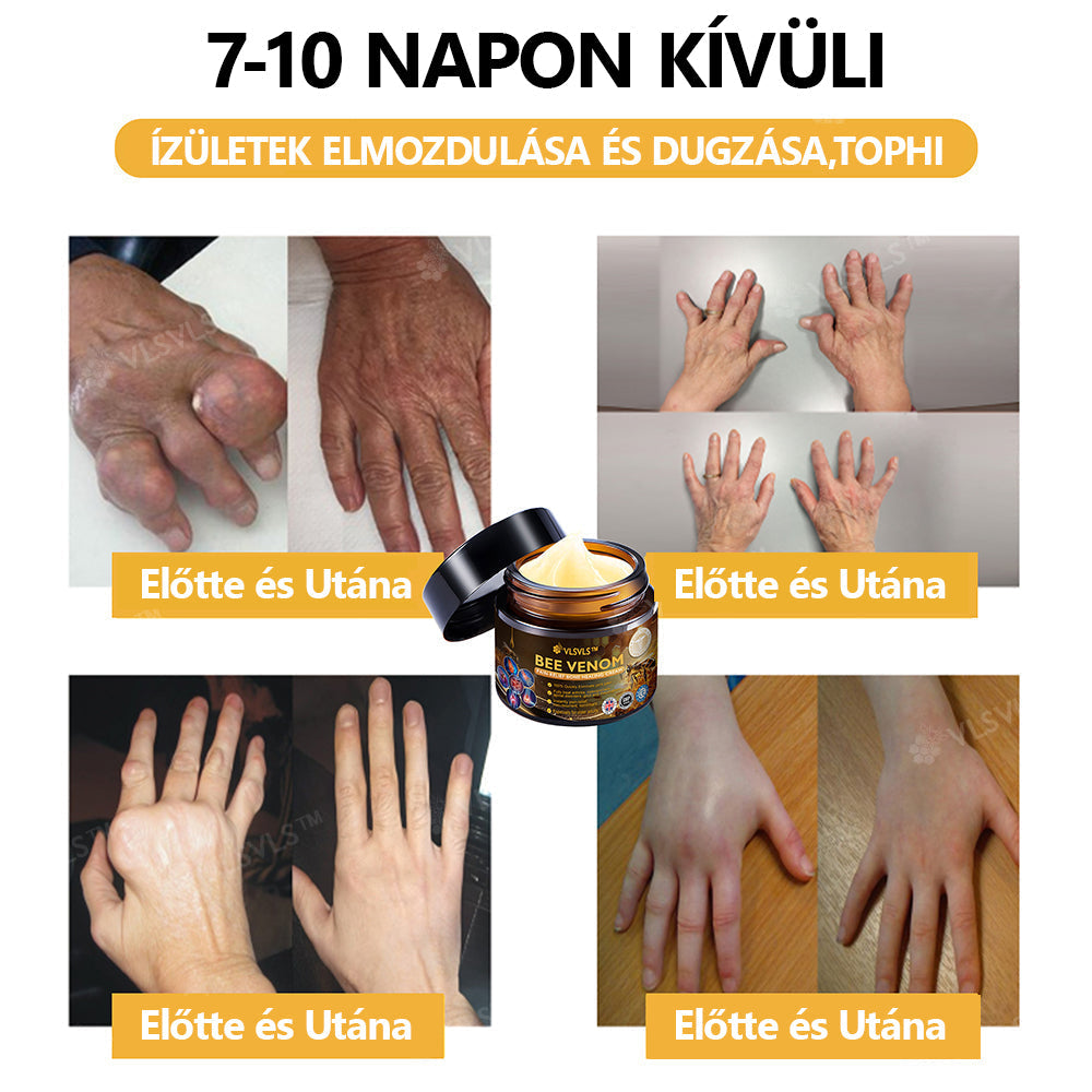 Hivatalos áruház:  🦵VLSVLS™ Méhméreg Arthritis terápiás krém(Kifejezetten az idősebb felnőttek számára & az AAOS ajánlja)🔥Utolsó nap promóció 70% le x💖💖