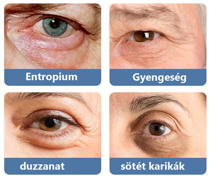 LOVILDS™ 💖 Dr. Gerald Jaar - Hungarian Eye Center Ajánlott termékek: Awaken peptid lifting szemgél x