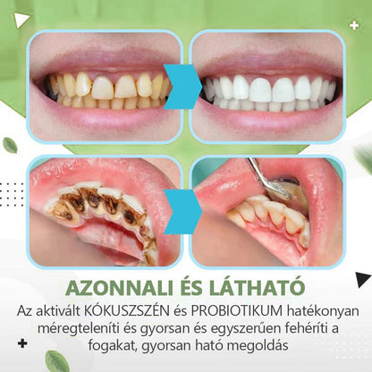 💥TLOPA™💥Ampoule fogkrém, A fogkő és a lepedékbaktériumok és különböző szájüregi problémák eltávolítása3