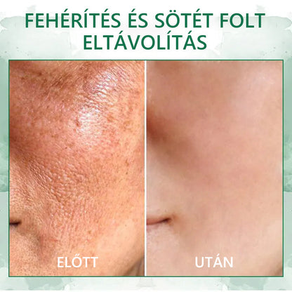 🌿Last Day Promotion SkinFirming🔥𝟕𝟎%𝐎𝐅𝐅 - 𝐅𝐮𝐛𝐬𝐭𝐚™  Szérum a Fiatalításért