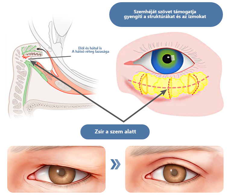 LOVILDS™ 💖 Dr. Gerald Jaar - Hungarian Eye Center Ajánlott termékek: Awaken peptid lifting szemgél x